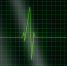 electrocardiogram-g0a8607c00_1280 - Сетевое издание Арбуз