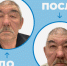 В астраханской больнице впервые сделали операцию пациенту с блефарохалязисом - Bloknot-Astrakhan.Ru