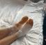 Астраханка попала в больницу с сильным обморожением конечностей - Астрахань 24